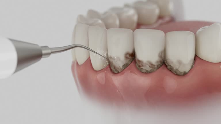 Trusted Wisdom Tooth Removal service in West Homestead, PA - Dentist Open Now